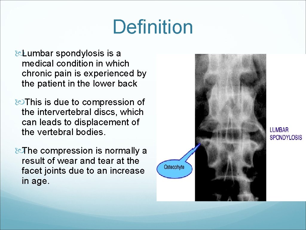 Definition Lumbar spondylosis is a medical condition in which chronic pain is experienced by