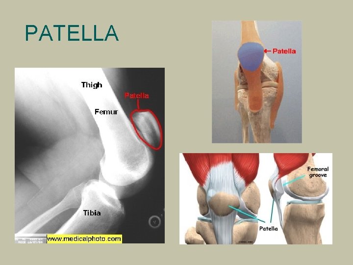 PATELLA 