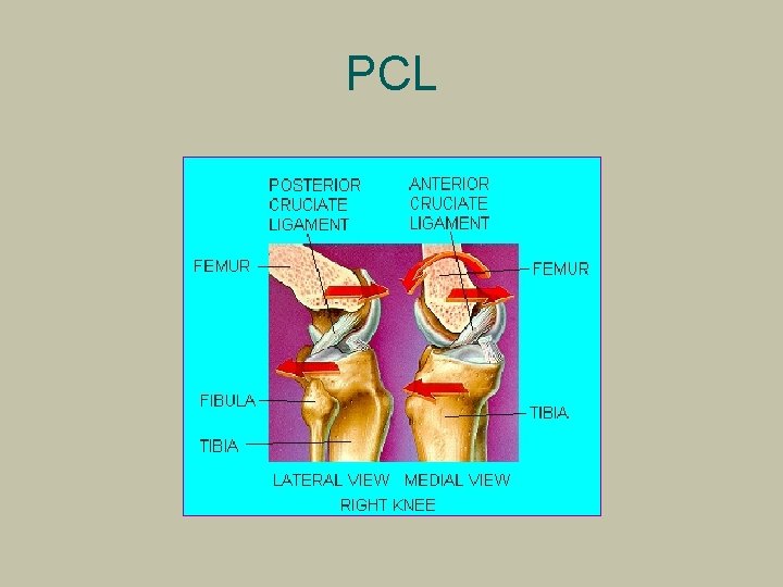 PCL 