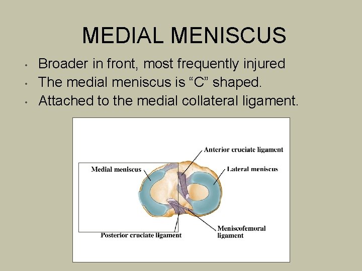 MEDIAL MENISCUS • • • Broader in front, most frequently injured The medial meniscus