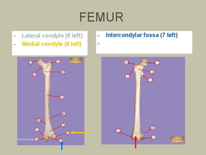 FEMUR • • Lateral condyle (6 left) Medial condyle (8 left) • • Intercondylar