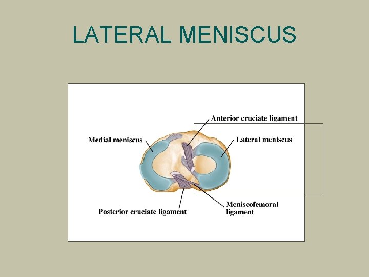 LATERAL MENISCUS 