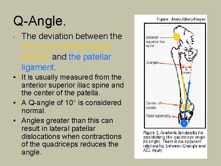 Q-Angle. • The deviation between the line of pull of the rectus femoris and