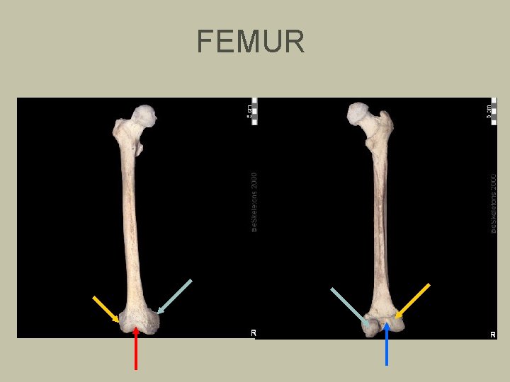 FEMUR 
