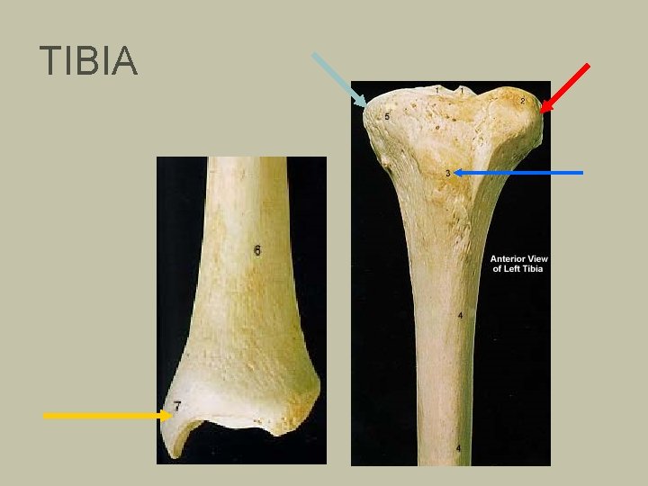 TIBIA 