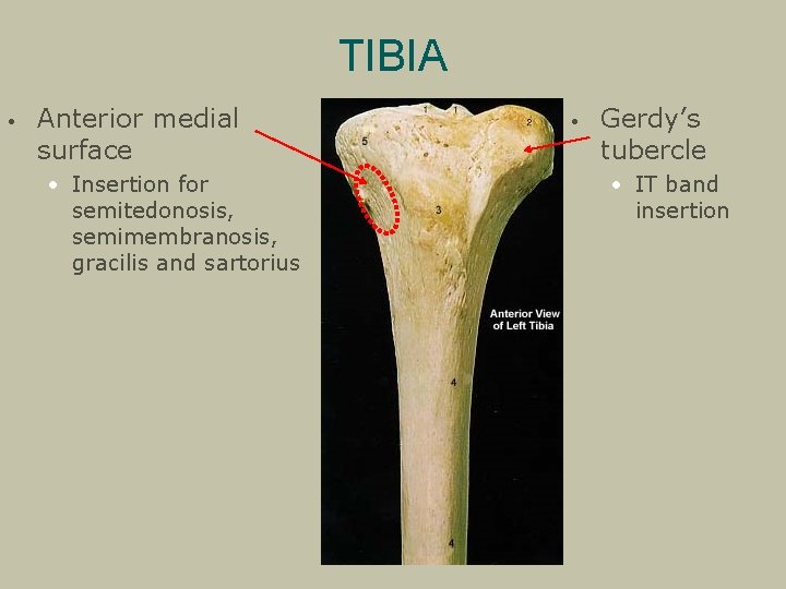 TIBIA • Anterior medial surface • Insertion for semitedonosis, semimembranosis, gracilis and sartorius •