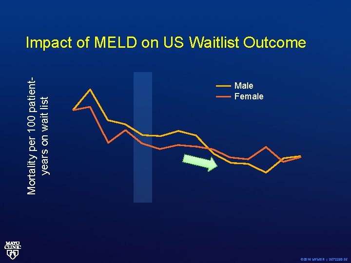 Mortality per 100 patientyears on wait list Impact of MELD on US Waitlist Outcome