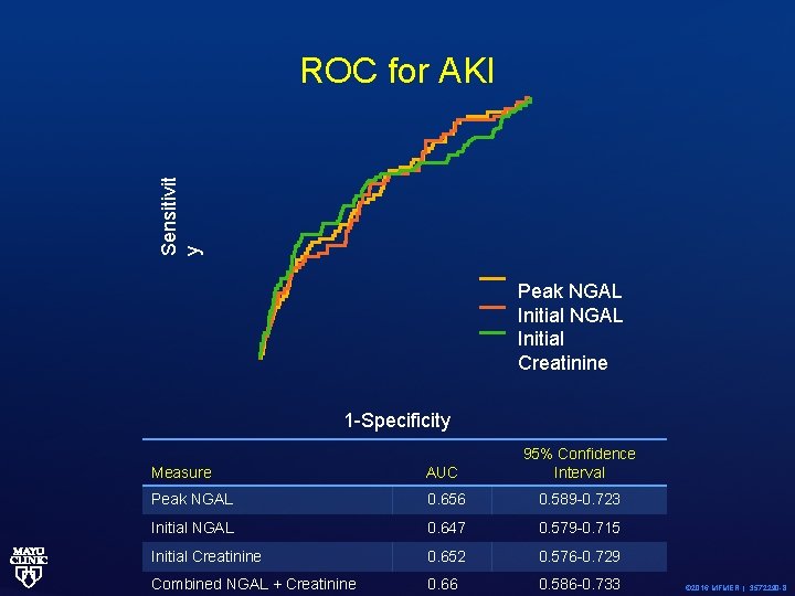 Sensitivit y ROC for AKI Peak NGAL Initial Creatinine 1 -Specificity AUC 95% Confidence