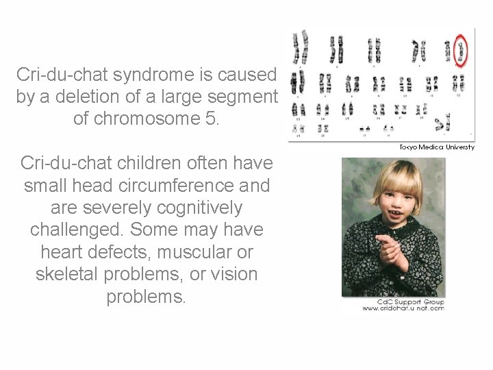 Cri-du-chat syndrome is caused by a deletion of a large segment of chromosome 5.