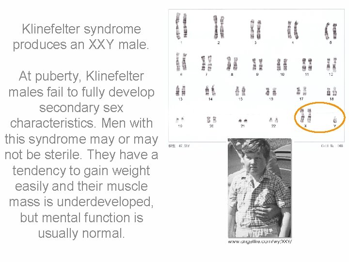 Klinefelter syndrome produces an XXY male. At puberty, Klinefelter males fail to fully develop