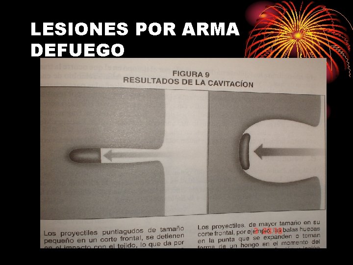 LESIONES POR ARMA DEFUEGO 