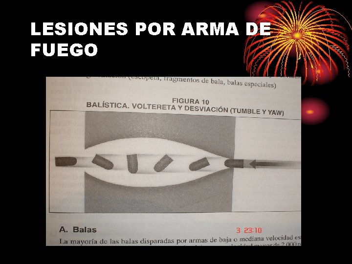 LESIONES POR ARMA DE FUEGO 