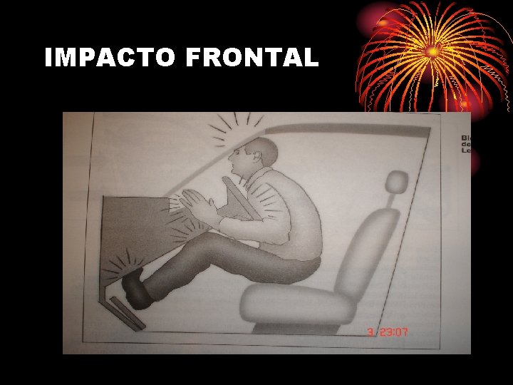IMPACTO FRONTAL 