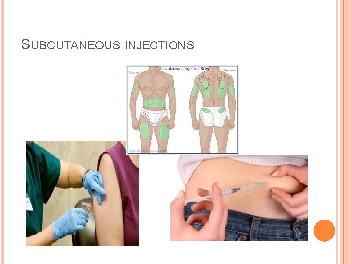 SUBCUTANEOUS INJECTIONS 