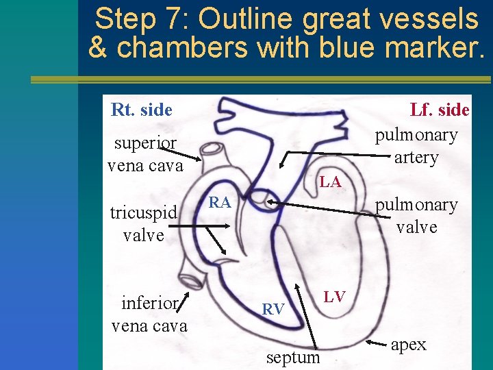 Step 7: Outline great vessels & chambers with blue marker. Rt. side Lf. side