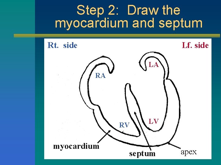Step 2: Draw the myocardium and septum Rt. side Lf. side LA RA RV