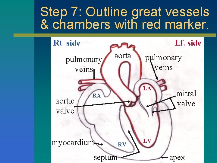 Step 7: Outline great vessels & chambers with red marker. Rt. side Lf. side