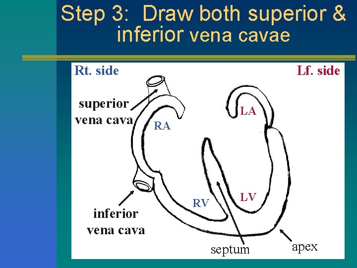 Step 3: Draw both superior & inferior vena cavae Rt. side superior vena cava