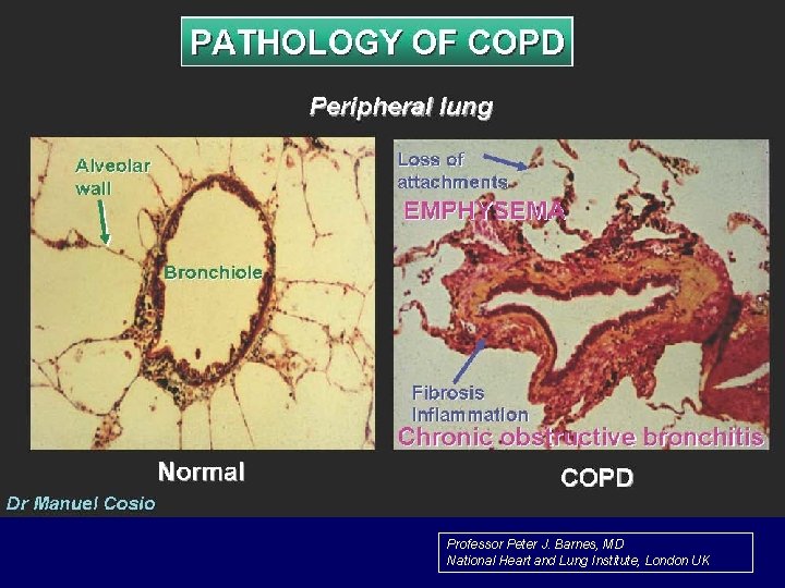 Professor Peter J. Barnes, MD National Heart and Lung Institute, London UK 