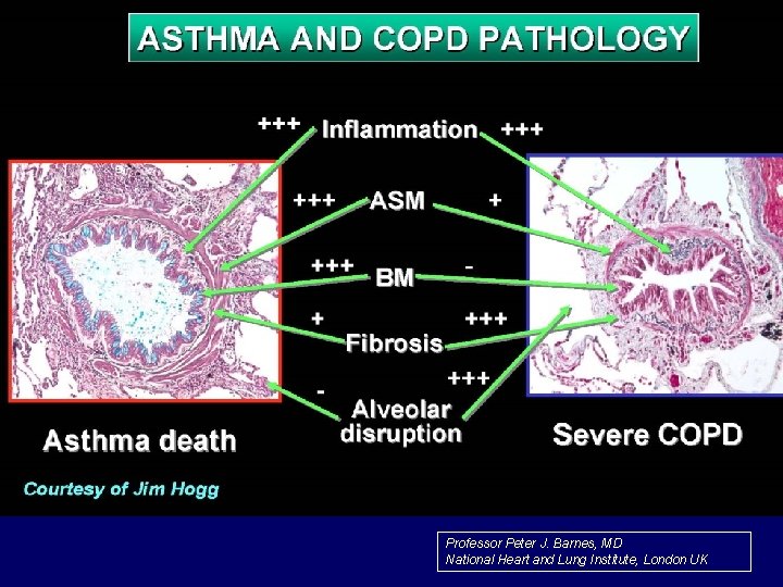 Professor Peter J. Barnes, MD National Heart and Lung Institute, London UK 