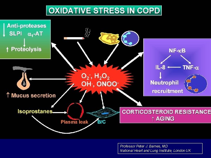 Professor Peter J. Barnes, MD National Heart and Lung Institute, London UK 