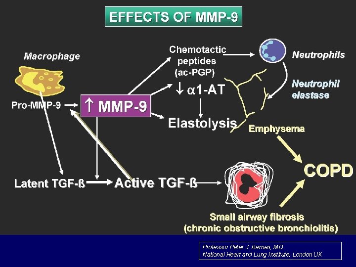 Professor Peter J. Barnes, MD National Heart and Lung Institute, London UK 