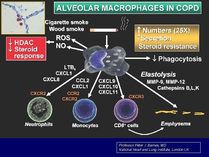 Professor Peter J. Barnes, MD National Heart and Lung Institute, London UK 