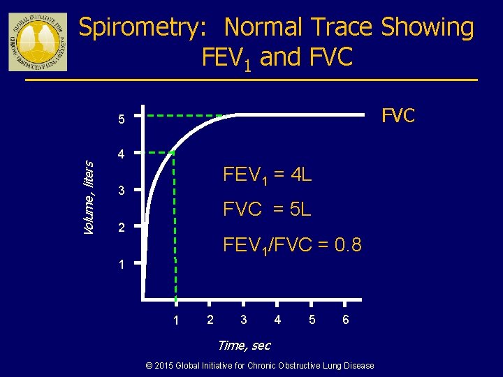 Spirometry: Normal Trace Showing FEV 1 and FVC 5 Volume, liters 4 FEV 1