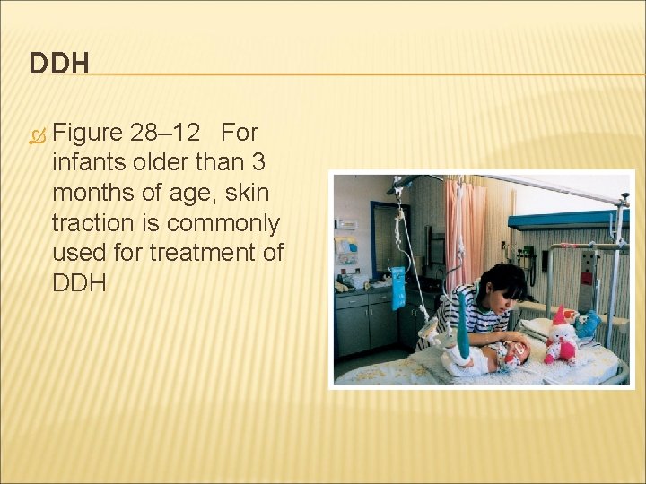 DDH Figure 28– 12 For infants older than 3 months of age, skin traction