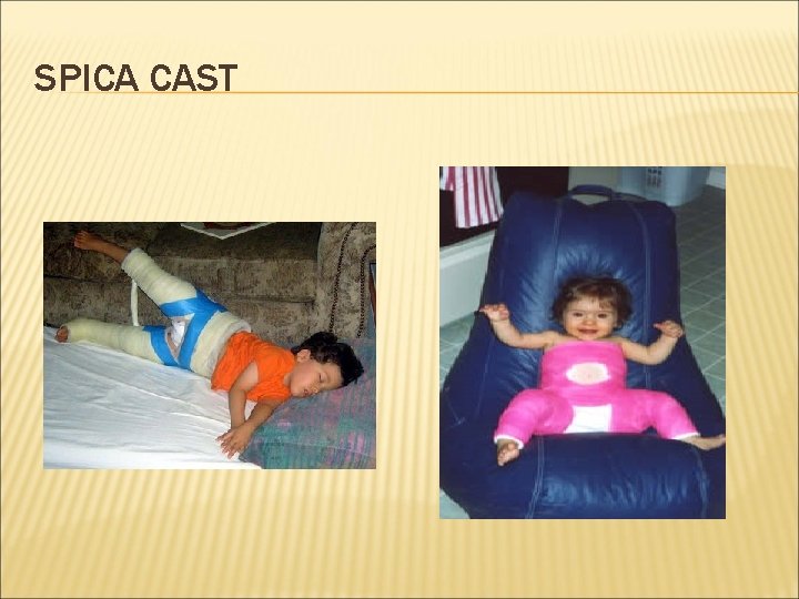SPICA CAST 
