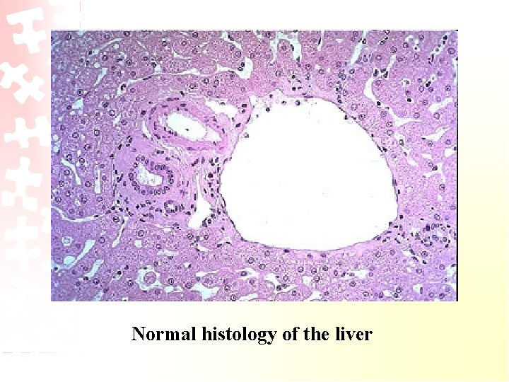Normal histology of the liver 