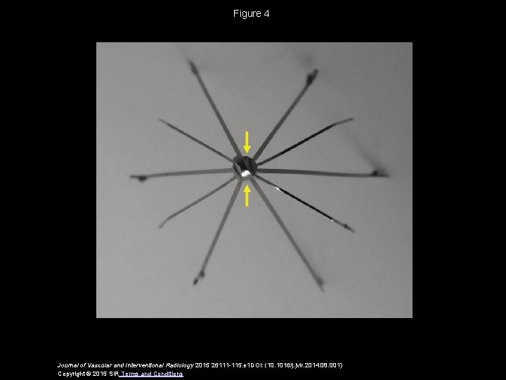 Figure 4 Journal of Vascular and Interventional Radiology 2015 26111 -115. e 1 DOI: