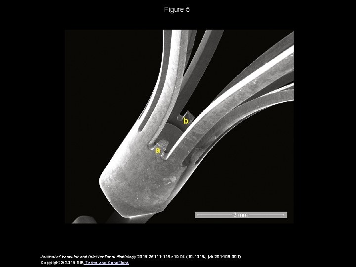 Figure 5 Journal of Vascular and Interventional Radiology 2015 26111 -115. e 1 DOI: