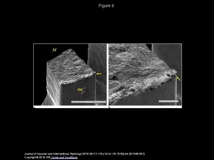 Figure 6 Journal of Vascular and Interventional Radiology 2015 26111 -115. e 1 DOI: