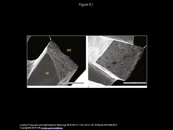 Figure E 1 Journal of Vascular and Interventional Radiology 2015 26111 -115. e 1
