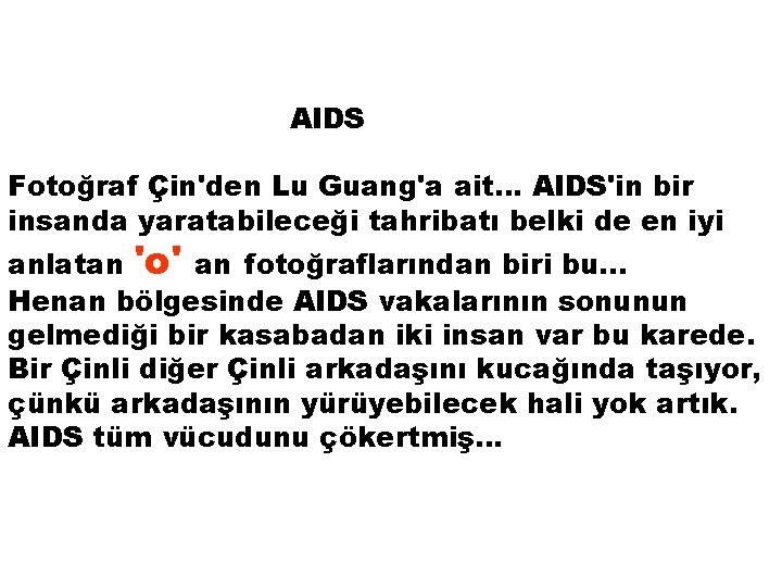 AIDS Fotoğraf Çin'den Lu Guang'a ait. . . AIDS'in bir insanda yaratabileceği tahribatı belki