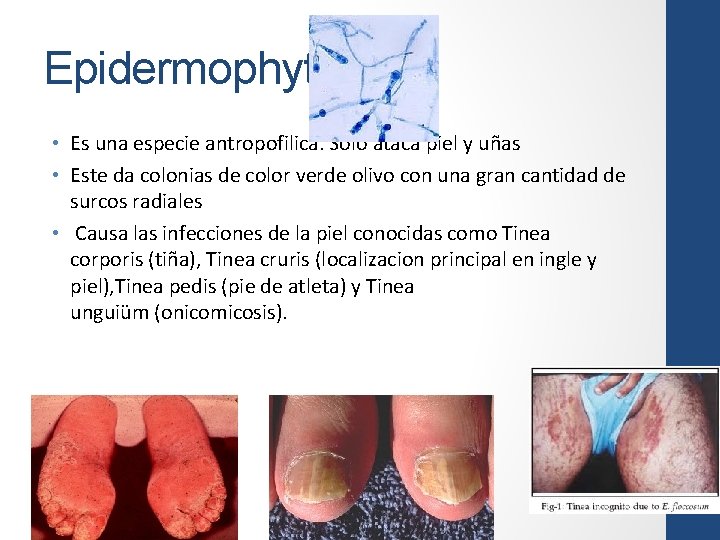Epidermophyton • Es una especie antropofilica. Solo ataca piel y uñas • Este da