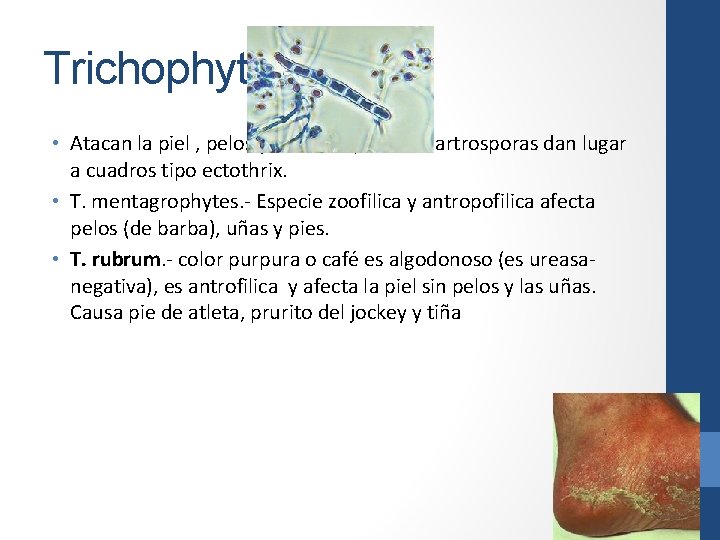 Trichophyton • Atacan la piel , pelos y uñas. En pelos las artrosporas dan