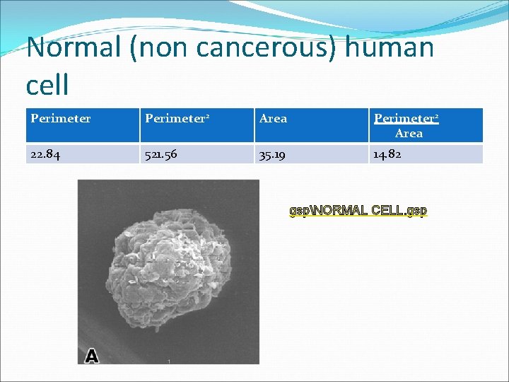 Normal (non cancerous) human cell Perimeter 2 Area 22. 84 521. 56 35. 19