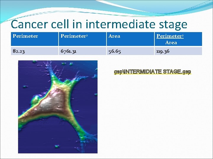 Cancer cell in intermediate stage Perimeter 2 Area 82. 23 6761. 31 56. 65