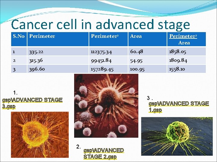 Cancer cell in advanced stage S. No Perimeter 2 Area 1 335. 22 112375.