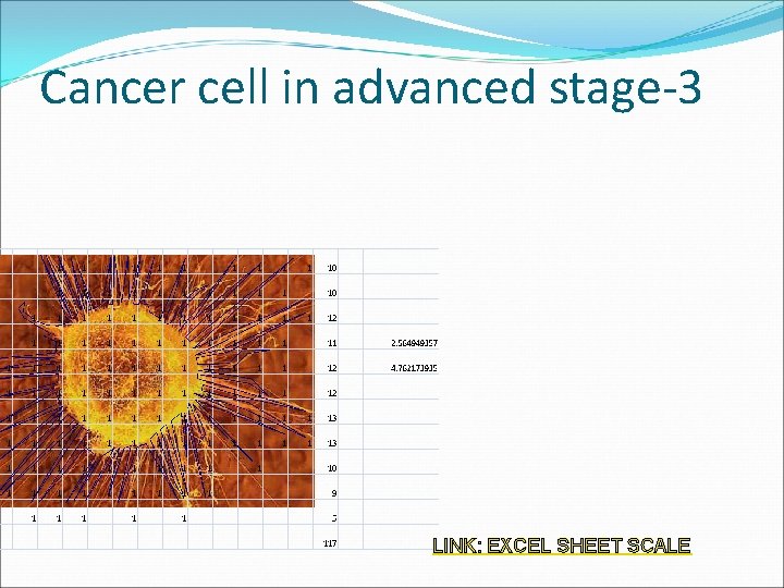 Cancer cell in advanced stage-3 LINK: EXCEL SHEET SCALE 