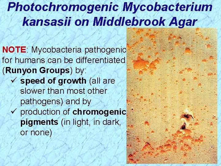 Photochromogenic Mycobacterium kansasii on Middlebrook Agar NOTE: Mycobacteria pathogenic for humans can be differentiated