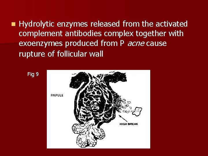 n Hydrolytic enzymes released from the activated complement antibodies complex together with exoenzymes produced