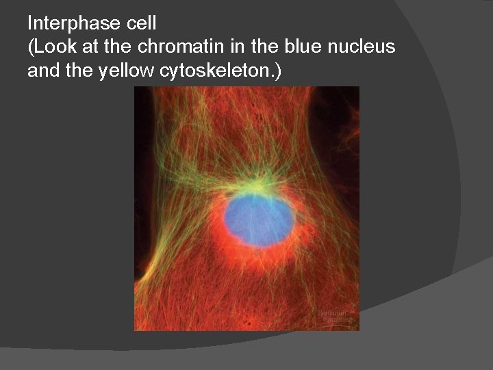 Interphase cell (Look at the chromatin in the blue nucleus and the yellow cytoskeleton.