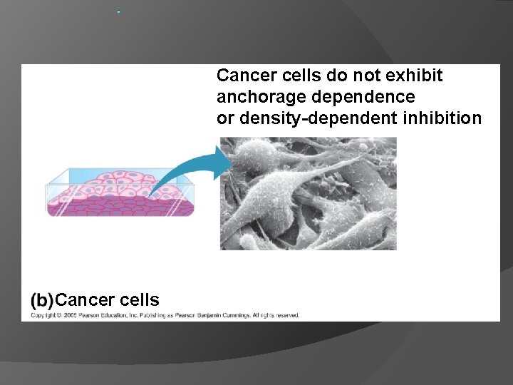 . Cancer cells do not exhibit anchorage dependence or density-dependent inhibition. 25 µm Cancer
