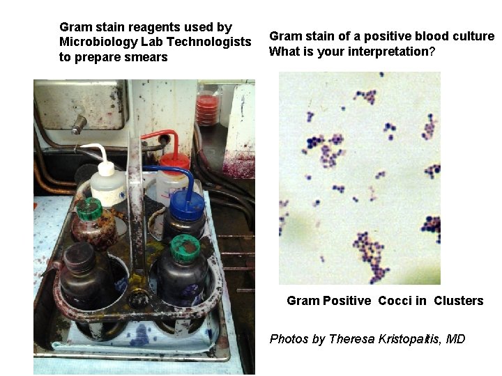 Gram stain reagents used by Microbiology Lab Technologists to prepare smears Gram stain of