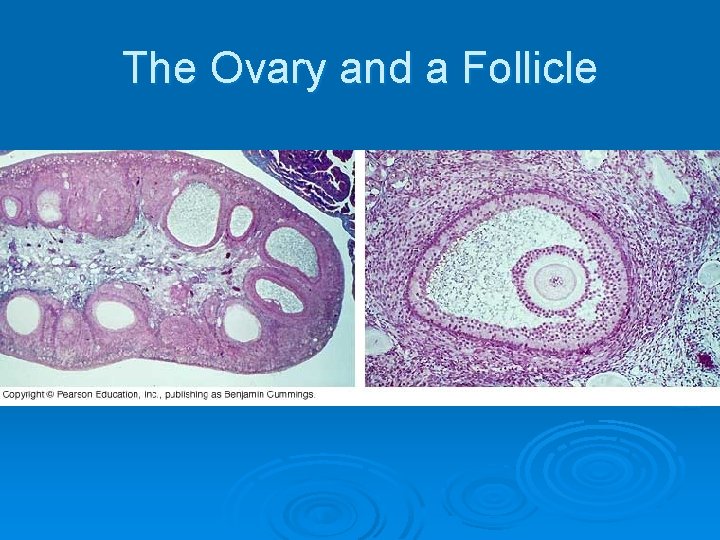 The Ovary and a Follicle 