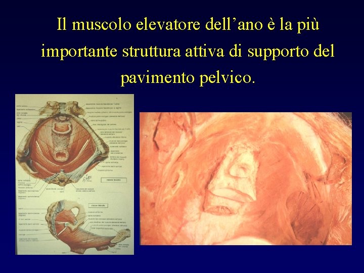 Il muscolo elevatore dell’ano è la più importante struttura attiva di supporto del pavimento