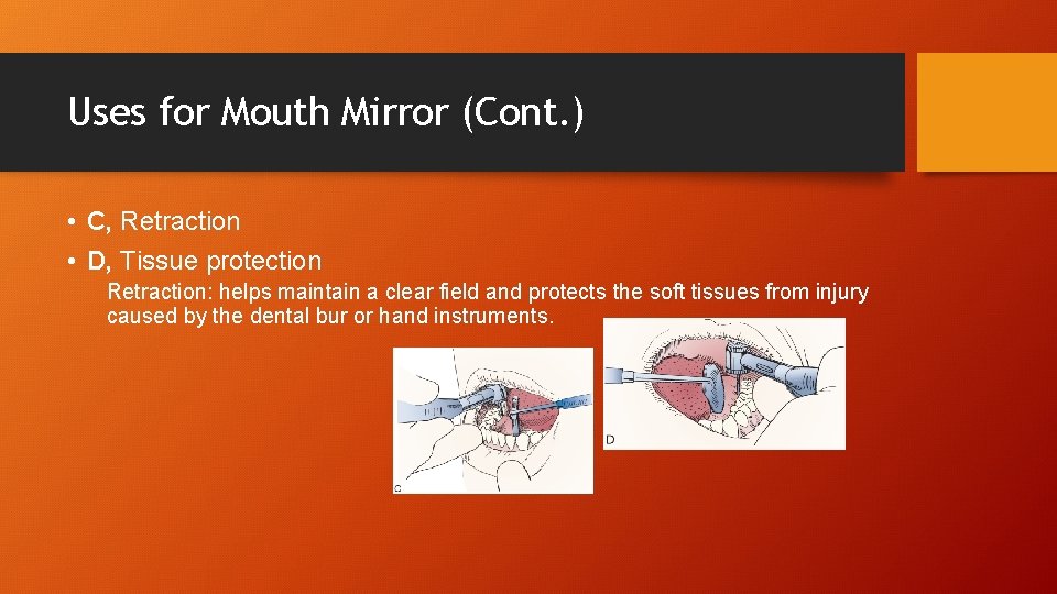 Uses for Mouth Mirror (Cont. ) • C, Retraction • D, Tissue protection Retraction: Uses for Mouth Mirror (Cont. ) • C, Retraction • D, Tissue protection Retraction: